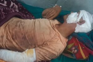 अछामको ढकारीमा बाघको आक्रमणबाट एक जना घाइते